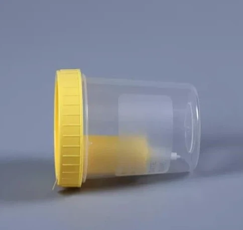 Disposable Urine Container
